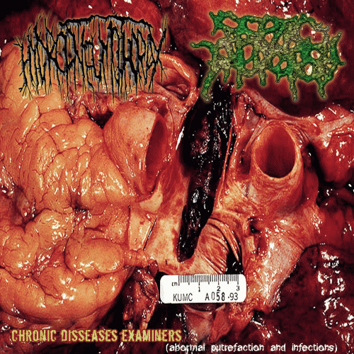 Septic Autopsy : Chronic Disseases Examiners (Abnormal Putrefaction and Infections)